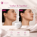 SKINQIRA ContourLift